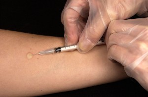 Man muss ja nicht hinsehen, wenn der Arzt die Spritze zur Impfung verabreicht - für alle jene gedacht, die zart besaitet sind. Foto: Gregor Knoblauch