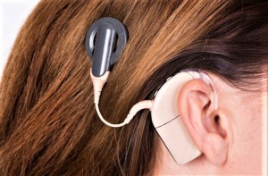 Das weltweit dünnste Cochlear-Implantat ist nun auch in Österreich verfügbar. Die neueste Generation hält selbst neurologischen MRT-Untersuchungen stand. Foto: Cochlear