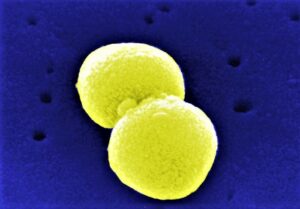 Die Pneumokokken-Impfung hilft dabei, impfpräventable Lungenerkrankungen zu reduzieren. Die Ärztekammer und die Apothekerkammer betonen einmal mehr die Wichtigkeit dieser Impfung. Foto: Wikipedia